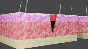 Partie 4 - Adhérence matrice-cellule et Mécanotransduction - La cicatrisation des petites plaies - Vidéo 2 sur 2