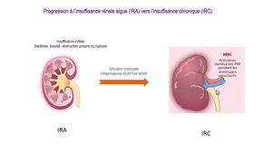 Partie 8 - Les réponses du rein à l'IL17 dans le contexte des infections, des maladies auto inflammatoires et d'une fibrose