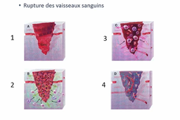 Partie 4 - Adhérence matrice-cellule et Mécanotransduction - La cicatrisation des petites plaies - Vidéo 1 sur 2